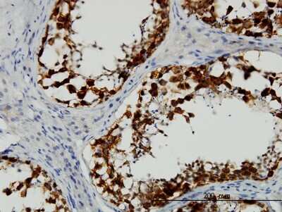 Immunohistochemistry-Paraffin: DAZ1 Antibody (3E3) [H00001617-M06]