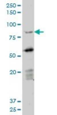 Western Blot: DAZ1 Antibody (3E3) [H00001617-M06]