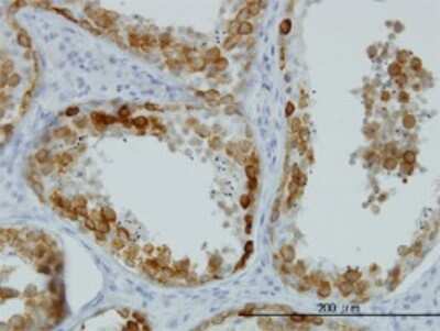 Immunohistochemistry-Paraffin: DAZ1 Antibody (3G10) [H00001617-M01]