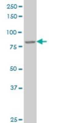 Western Blot: DAZ1 Antibody (3G10) [H00001617-M01]