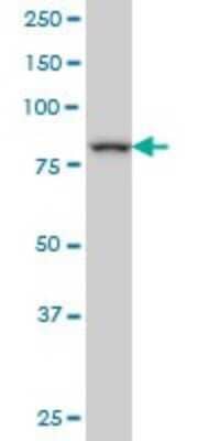 Western Blot: DAZ1 Antibody (4F3) [H00001617-M04]