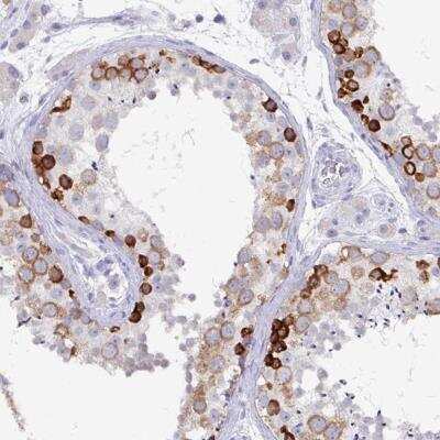 Immunohistochemistry: DAZ1 Antibody [NBP2-46743]