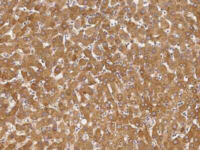 Immunohistochemistry-Paraffin: DAZ1 Antibody [NBP2-98991]