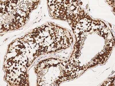 Immunohistochemistry-Paraffin: DAZ1 Antibody [NBP2-98991]
