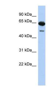 Western Blot: DAZ1 Antibody [NBP1-57130]