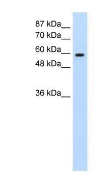 Western Blot: DAZ2 Antibody [NBP1-80443]