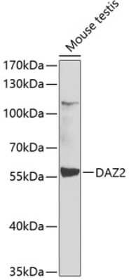 Western Blot: DAZ2 AntibodyBSA Free [NBP2-92500]