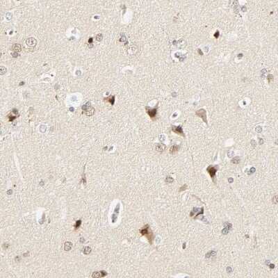 Immunohistochemistry-Paraffin: DAZAP1 Antibody [NBP1-82740]