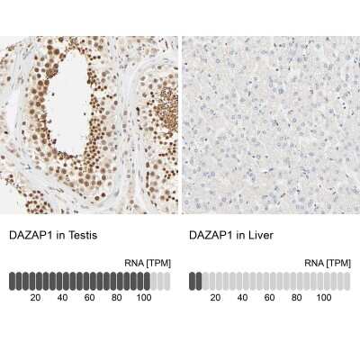 Immunohistochemistry-Paraffin: DAZAP1 Antibody [NBP1-82740]