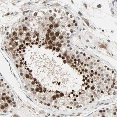 Immunohistochemistry-Paraffin: DAZAP1 Antibody [NBP1-82741]