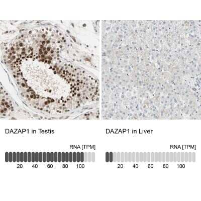 Immunohistochemistry-Paraffin: DAZAP1 Antibody [NBP1-82741]