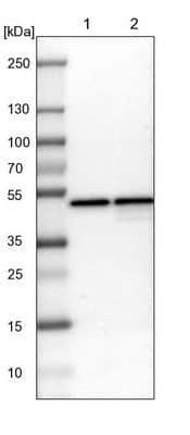 Western Blot: DAZAP1 Antibody [NBP1-82741]