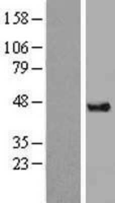 Western Blot: DAZAP1 Overexpression Lysate [NBL1-09724]