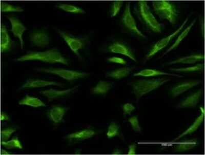 Immunocytochemistry/ Immunofluorescence: DAZAP2 Antibody (3G21) [H00009802-M01]