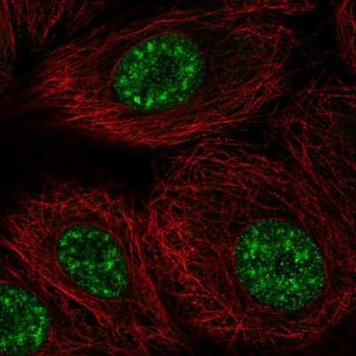 Immunocytochemistry/ Immunofluorescence: DAZAP2 Antibody [NBP2-58696]