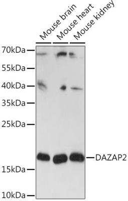 Western Blot: DAZAP2 AntibodyAzide and BSA Free [NBP2-92144]