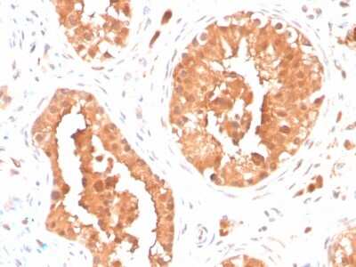 Immunohistochemistry-Paraffin: DAZL Antibody (DAZL/4253) [NBP3-07840]