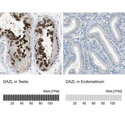 Immunohistochemistry-Paraffin: DAZL Antibody [NBP1-85306]