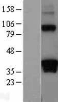 Western Blot: DAZL Overexpression Lysate [NBL1-09725]