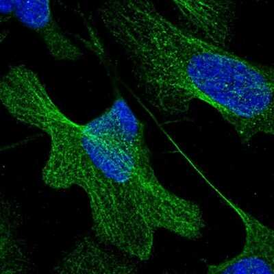 Immunocytochemistry/ Immunofluorescence: DBC1 Antibody [NBP1-85303]