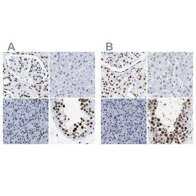 Immunohistochemistry-Paraffin: DBC1 Antibody [NBP1-85304]