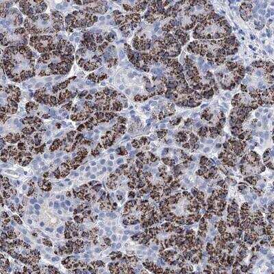 Immunohistochemistry-Paraffin: DBC1 Antibody [NBP1-85303]