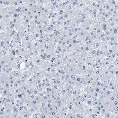 Immunohistochemistry-Paraffin: DBC1 Antibody [NBP1-85304]