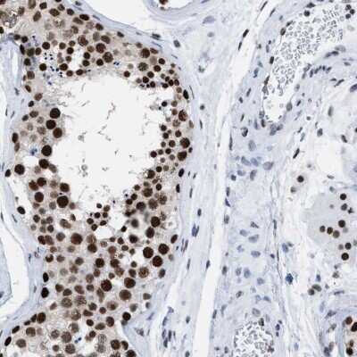 Immunohistochemistry-Paraffin: DBC1 Antibody [NBP1-85304]