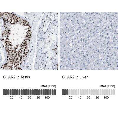 Immunohistochemistry-Paraffin: DBC1 Antibody [NBP1-85304]