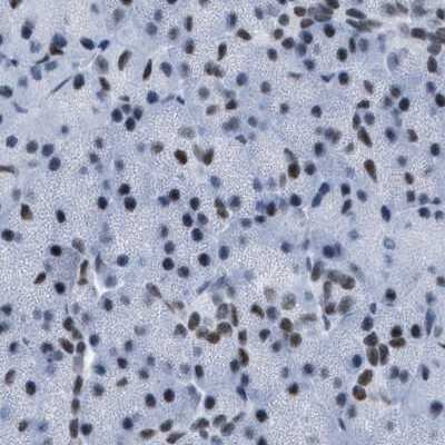 Immunohistochemistry-Paraffin: DBC1 Antibody [NBP1-85304]