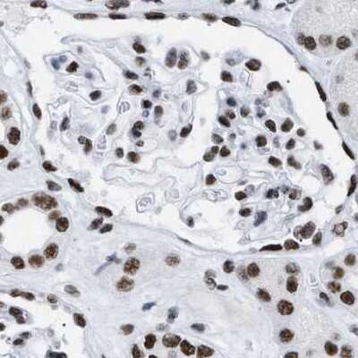 Immunohistochemistry-Paraffin: DBC1 Antibody [NBP1-85304]