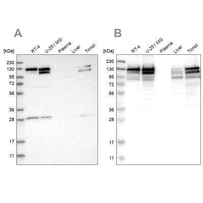 Western Blot: DBC1 Antibody [NBP1-85304]