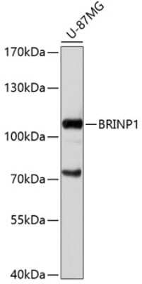 Western Blot: DBC1 AntibodyAzide and BSA Free [NBP2-92049]