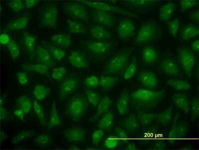 Immunocytochemistry/ Immunofluorescence: DBC1/p30 Antibody (4E6) [H00057805-M04]