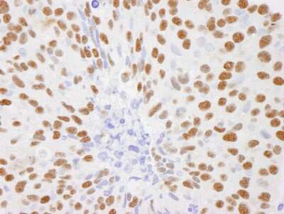 Immunohistochemistry: DBC1/p30 Antibody [NB100-40858]