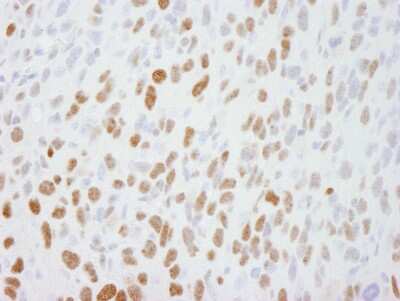 Immunohistochemistry: DBC1/p30 Antibody [NB100-40858]