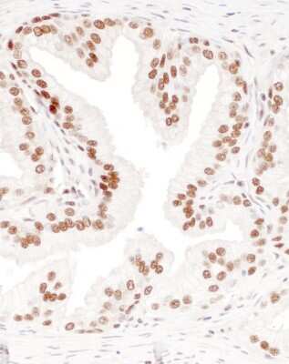 Immunohistochemistry-Paraffin: DBC1/p30 Antibody [NBP2-22294]