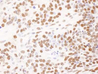 Immunohistochemistry-Paraffin: DBC1/p30 Antibody [NBP2-22294]