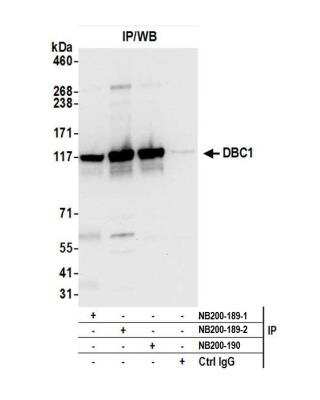 Immunoprecipitation: DBC1/p30 Antibody [NB200-189]