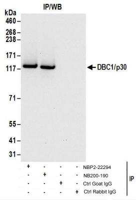 Immunoprecipitation: DBC1/p30 Antibody [NBP2-22294]