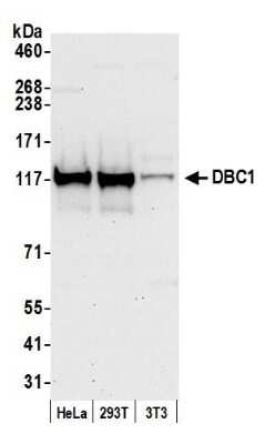 Western Blot: DBC1/p30 Antibody [NB200-189]