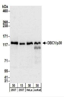 Western Blot: DBC1/p30 Antibody [NBP2-22294]