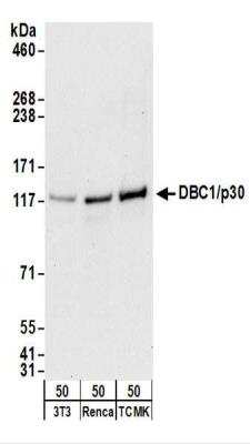 Western Blot: DBC1/p30 Antibody [NBP2-22294]