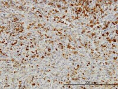 Immunohistochemistry-Paraffin: DBF4 Antibody (6G9) [H00010926-M01]