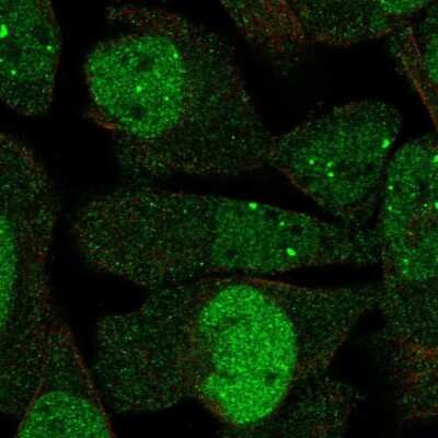 Immunocytochemistry/ Immunofluorescence: DBF4 Antibody [NBP2-55268]