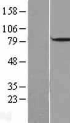 Western Blot: DBF4 Overexpression Lysate [NBL1-09726]