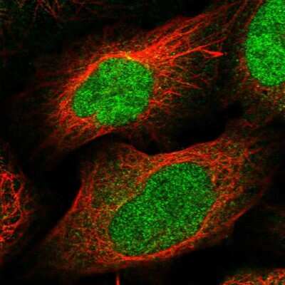 Immunocytochemistry/ Immunofluorescence: DBF4B Antibody [NBP2-13900]