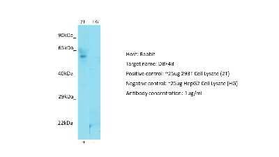 Western Blot: DBF4B Antibody [NBP2-87247]