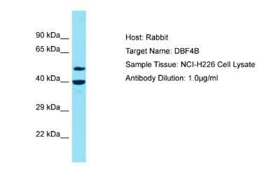 Western Blot: DBF4B Antibody [NBP2-87248]