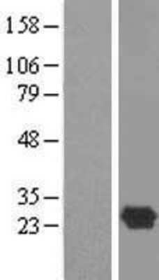 Western Blot: DBNDD1 Overexpression Lysate [NBL1-09729]